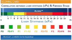 Fibroscan Score Chart