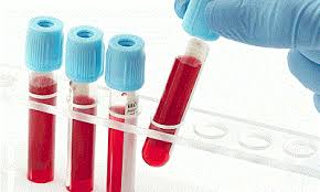 Hep C testing walk in labs